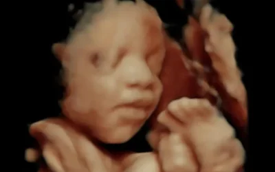3D ultrasound image of a fetus showing facial features and hand position, illustrating the prenatal experience offered by 4D Moments.