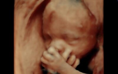 3D ultrasound image of a fetus in utero, showcasing facial features and hand positioned near the mouth, emphasizing the high-quality imaging services offered by 4D Moments in Kalamazoo and Grand Rapids, Michigan.