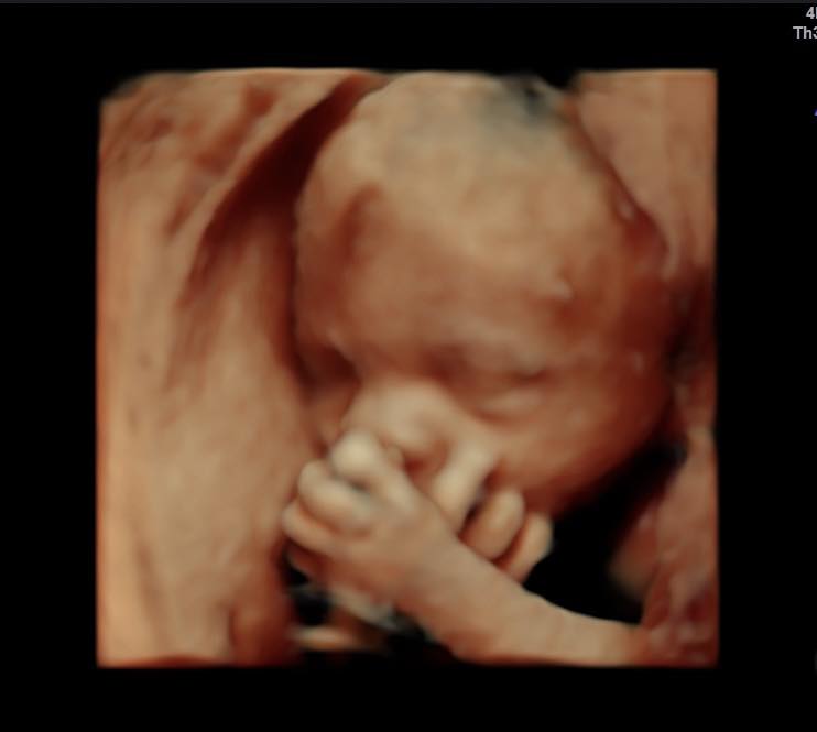 3D Ultrasound in Grand Rapids, MI