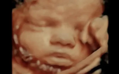 3D ultrasound image of a fetus with a hand on its face, showcasing details of the baby's features, emphasizing family-centered ultrasound services at 4D Moments in Kalamazoo and Grand Rapids, Michigan.