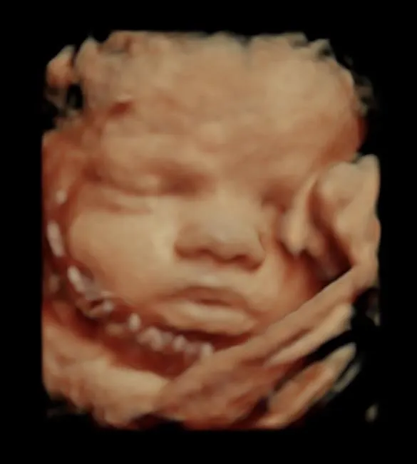 3D Ultrasound in Kalamazoo, MI – Service Area