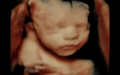 Making Memories: Planning a 3D Ultrasound Family Viewing in Grand Rapids