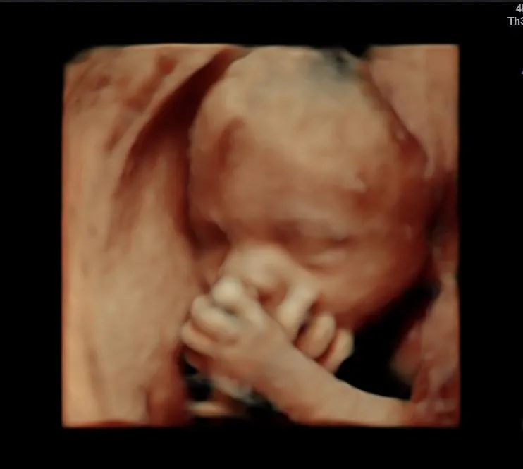 3D Ultrasound Services in Kalamazoo, Michigan